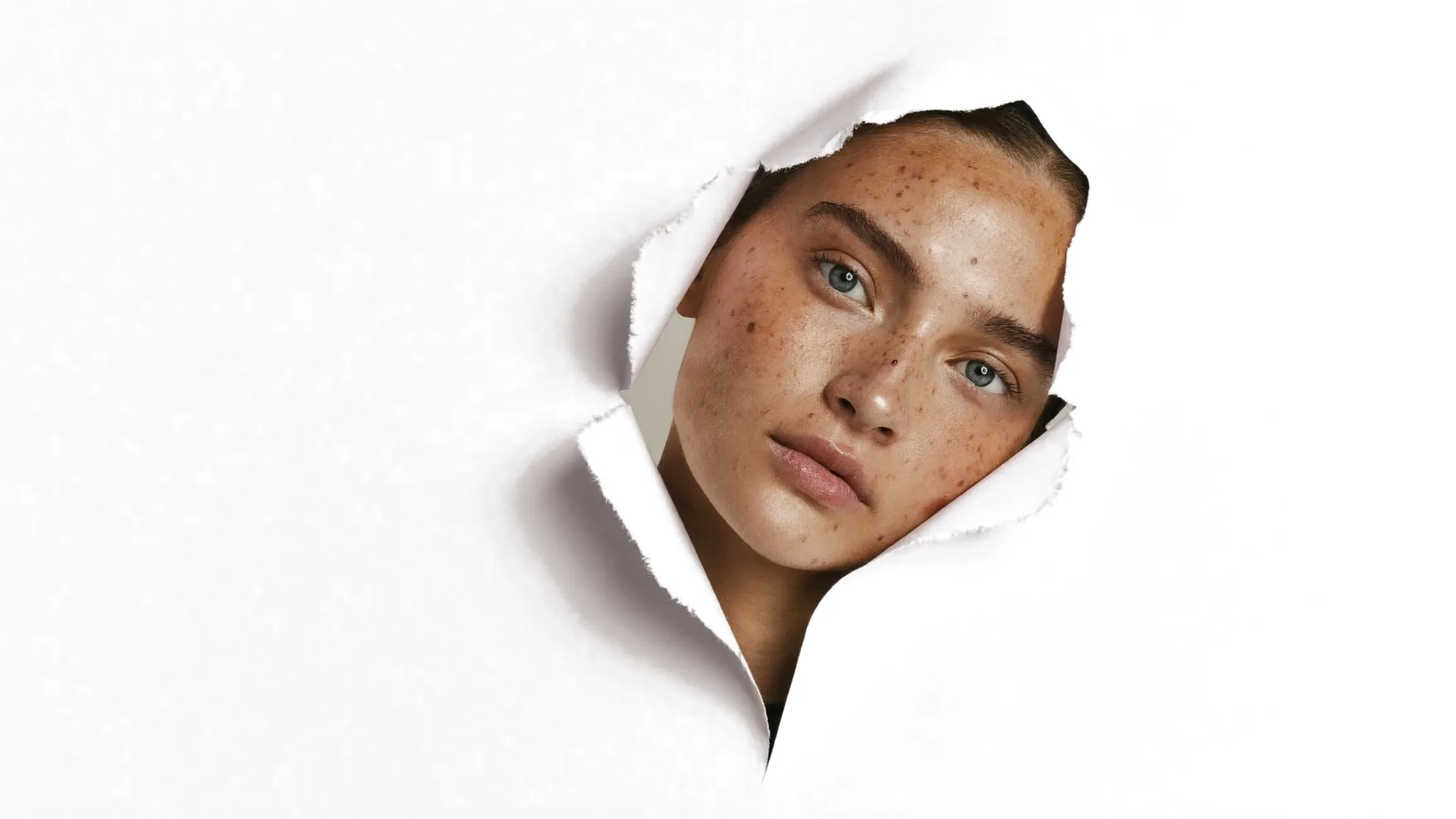 Portrait with natural freckles and even skin — Isabels Beauty Club Munich-Laim